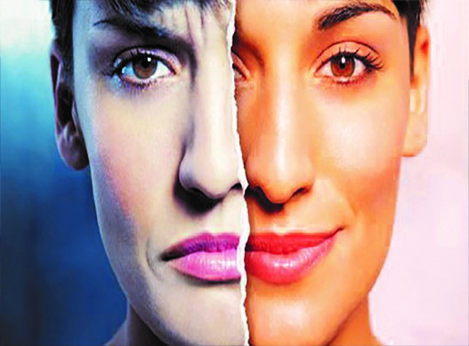 اختلال دوقطبی 